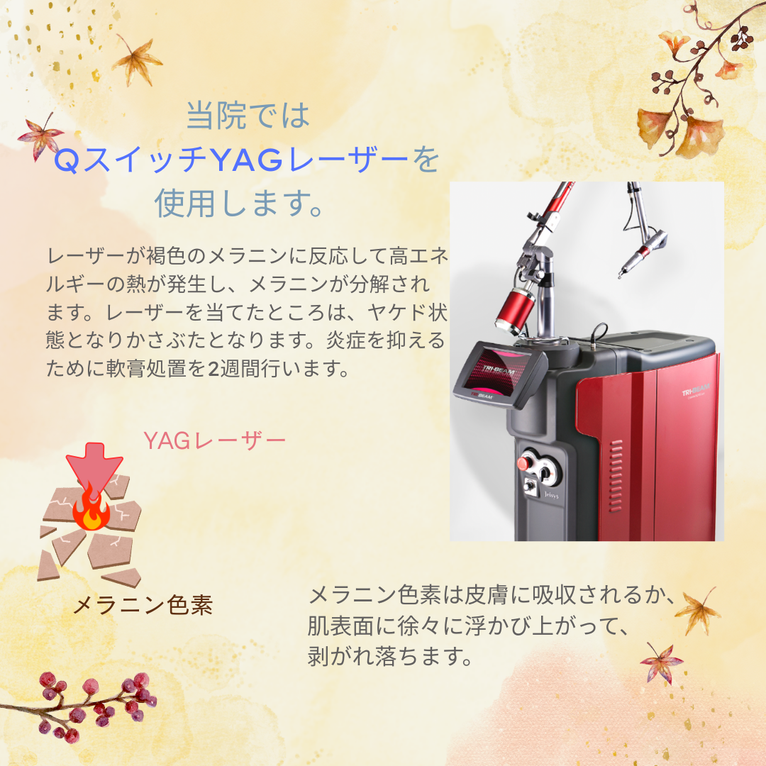 美容キャンペーン「シミ取り放題」POP